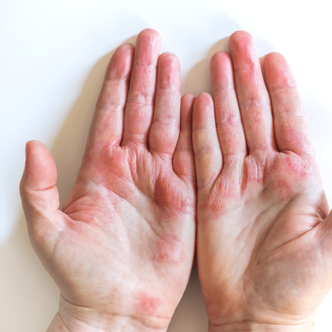 Gentle cleansing for dry, sensitive skin