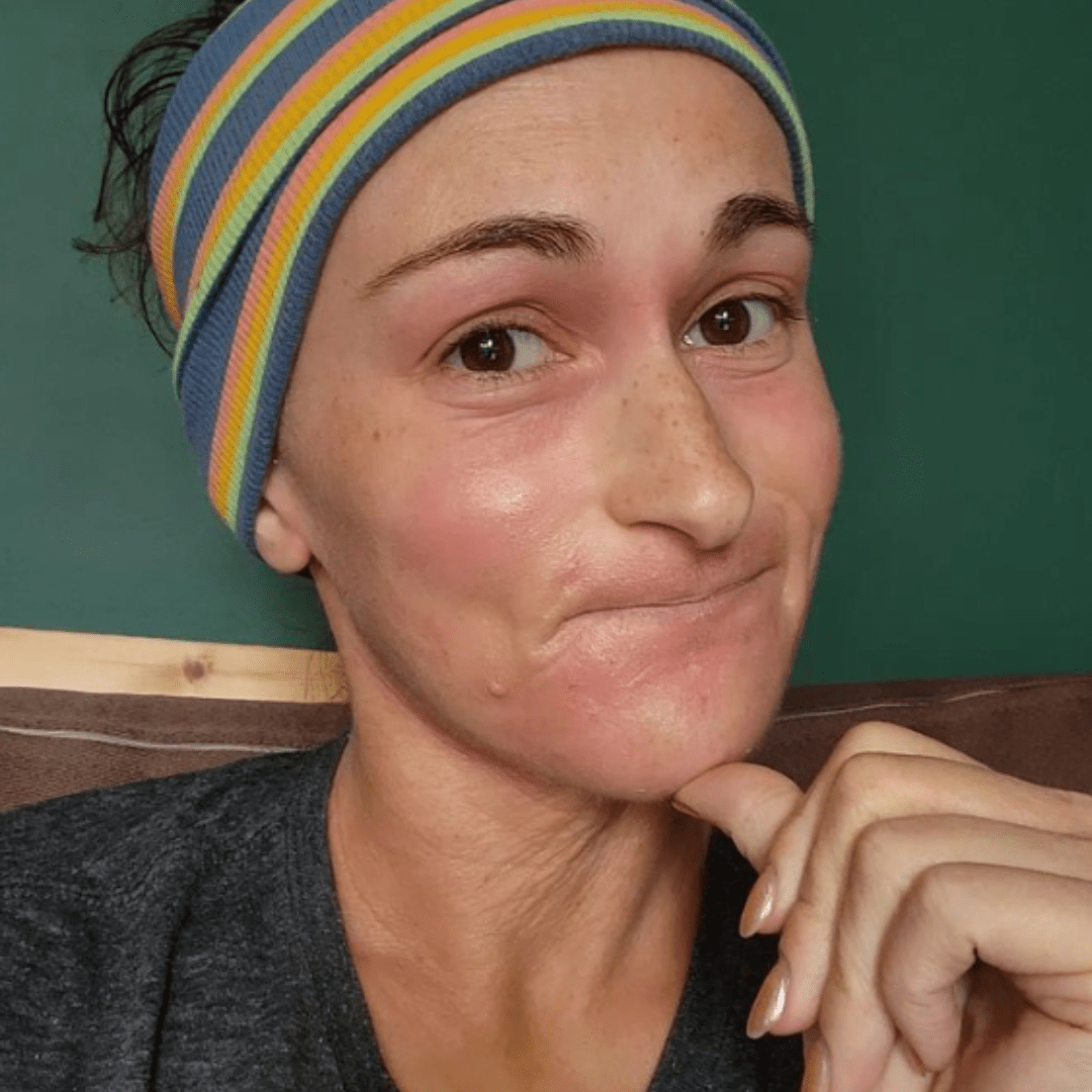 Briana Banos - Topical Steroid Withdrawal Q&A